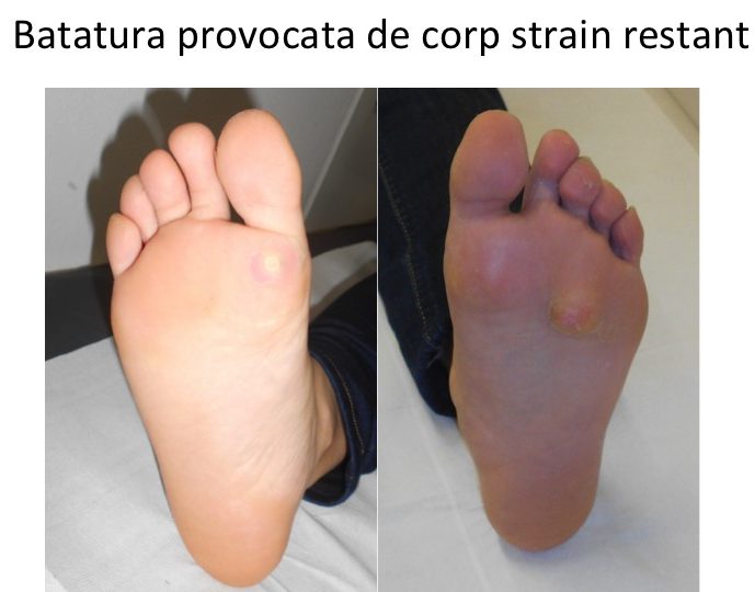 Batatura corp strain