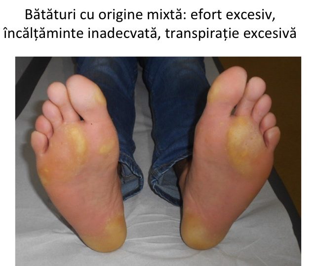 Bataturi cu origine mixta