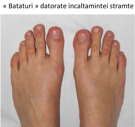 Bataturi degete site