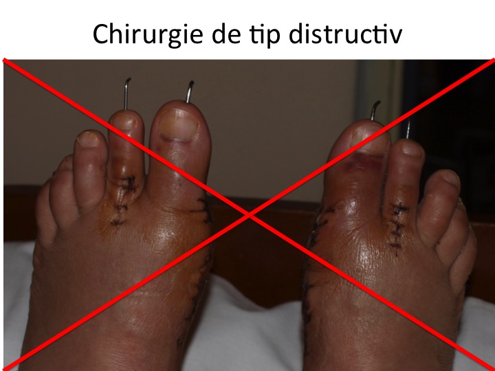 Chirurgie distructiva