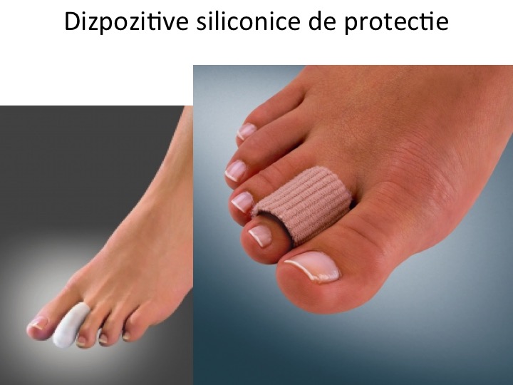 Dispozitiv siliconic de protectie 2