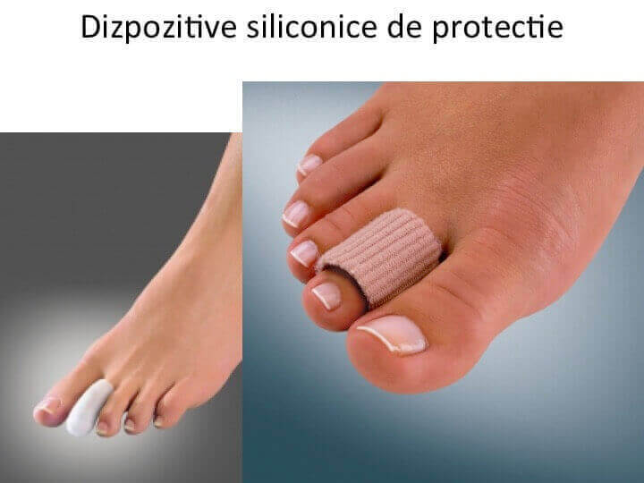 Dispozitiv siliconic de protectie 2
