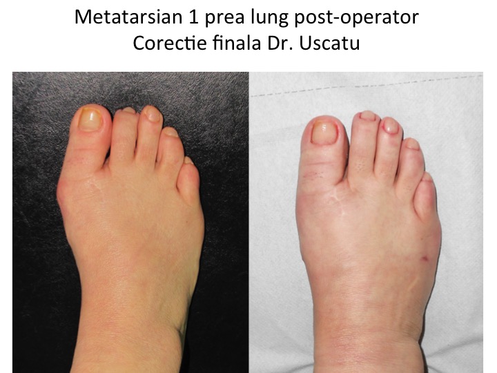 M1 restant prea lung