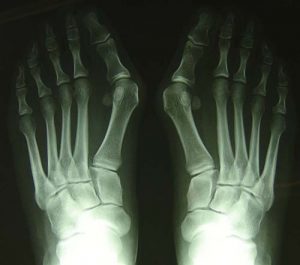 Radiografie