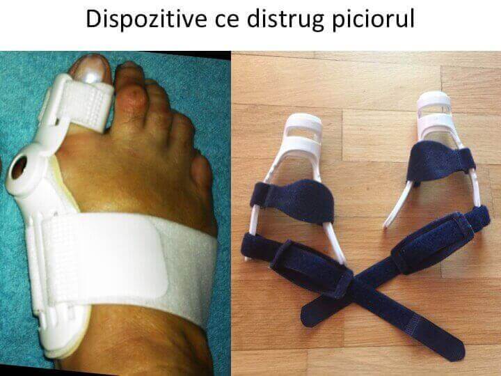 Distrug piciorul